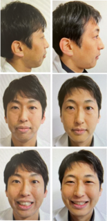 }1.png