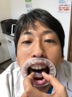 自分の顔2.jpg